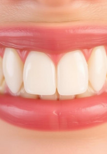 Керамические коронки на зубы: полное руководство по восстановлению улыбки