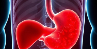 Жировой гепатоз: Каковы последствия, если не лечить это заболевание печени?