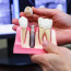 Имплантация зубов: показания, противопоказания и выполнение