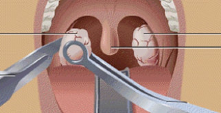 Метаболический ацидоз: что это такое у взрослых и как с этим справляться