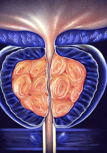 Что делать, если у тебя болит кишечник: советы и рекомендации
