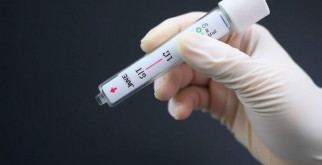 Экспресс-тесты для иммунохроматографического выявления: что это такое и как они работают?