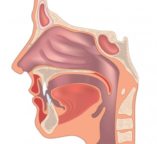 Методы устранения перфорации носовой перегородки