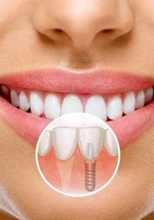 Уникальные жители Австралии: кто обитает на зеленом континенте?