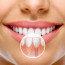 Имплантация зубов: новая жизнь вашей улыбке