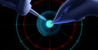 Радиоволновой метод удаления: новое дыхание в ЛОР-практике