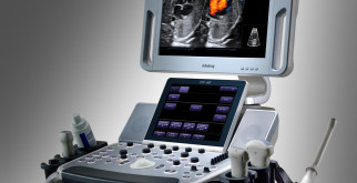Виды оборудования для ультразвуковой диагностики