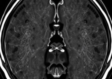 МРТ отделов позвоночника: понятный гид для тех, кто собирается на исследование