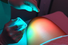 Преимущества лазерной эпиляции: мифы и реальность