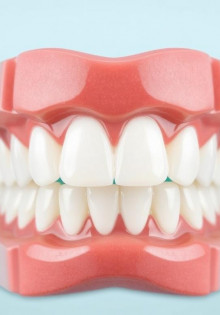 Керамические брекеты