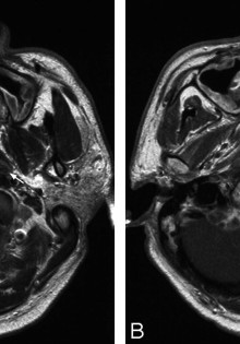Эмоционально-волевые нарушения: что это и как с ними справиться