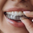 Элайнеры для зубов: особенности использования
