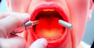 Фарингоскопия: что показывает исследование и зачем оно нужно