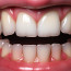 Революция в стоматологии: новые технологии и подходы