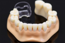 Съемное или несъемное протезирование зубов: как не промахнуться с выбором