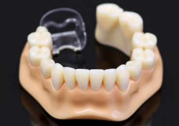 Съемное или несъемное протезирование зубов: как не промахнуться с выбором