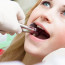 Когда можно кушать после удаления зуба?