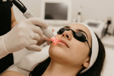 Эпиляция зоны усиков и подбородка: подготовка, ход процедуры и уход за кожей