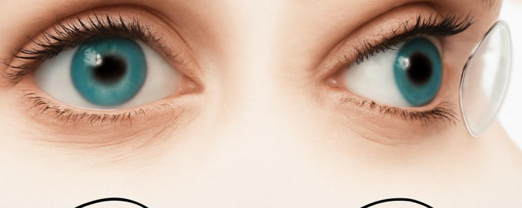 Кератоконус: полный гид по загадочной болезни глаз, о которой нужно знать