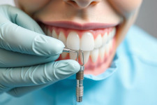Улыбка без компромиссов: как лечат зубы сегодня и когда стоит выбрать имплантацию