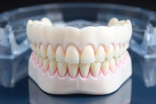 Протезирование зубов: как вернуть комфорт и улыбку без лишних страхов