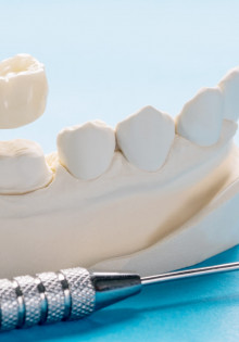 Коронки: что это и для чего они используются