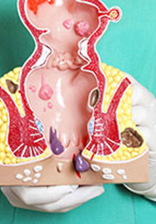 Какие болезни лечит проктология?