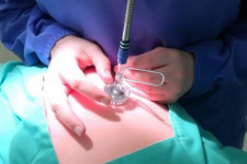 Установка цистостомы: как проходит процедура