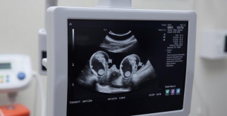 УЗИ: Все, что нужно знать о методах диагностики и их значении для здоровья