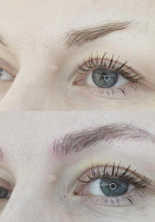 Дисфония: что это такое и как с ней справиться