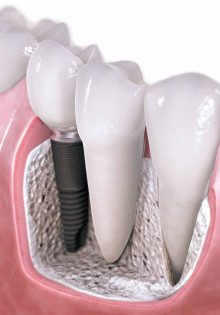 Что делать, если часто снятся кошмары и как от них избавиться