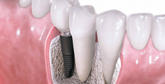 Что делать, если часто снятся кошмары и как от них избавиться