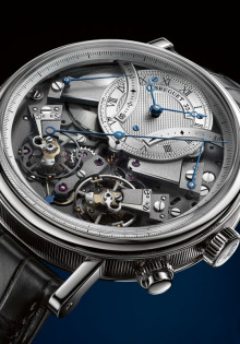 Что такое спондилез позвоночника и как с ним справиться