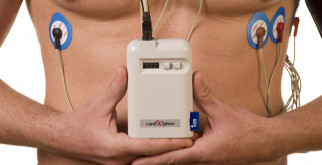 Как устроены холтеры для суточного мониторинга ЭКГ?