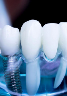 Тахилалия: что это и как она влияет на нашу жизнь