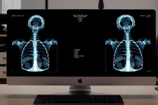 Универсальный онлайн DICOM-вьюер: как выбрать инструмент, который действительно поможет врачам и техникам