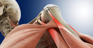 Рабдомиолиз: что это такое и как его распознать