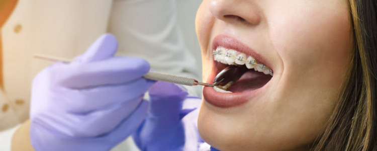 Какую выбрать ортодонтическую клинику?