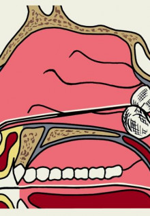 В мире насекомоядных: удивительные существа, более чем просто хищники