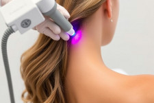 Неодимовая лазерная эпиляция: как работает 1064 нм и кому она действительно нужна