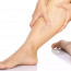 Инновационное лечение варикоза: сохраняйте здоровье ног с помощью лазера