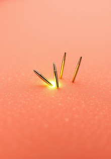 Микроигольчатый RF-лифтинг: что это, кому подходит и чего реально ждать