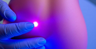 Лазерная эпиляция: что это такое и стоит ли доверять своему телу лазеру?