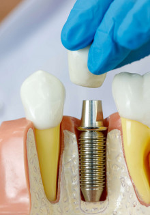 Гиперастоз: что это и как с ним справиться