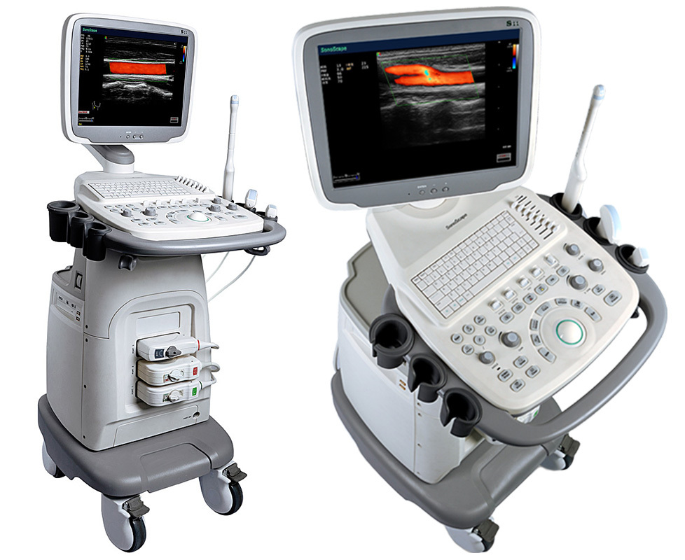 Виды оборудования для ультразвуковой диагностики