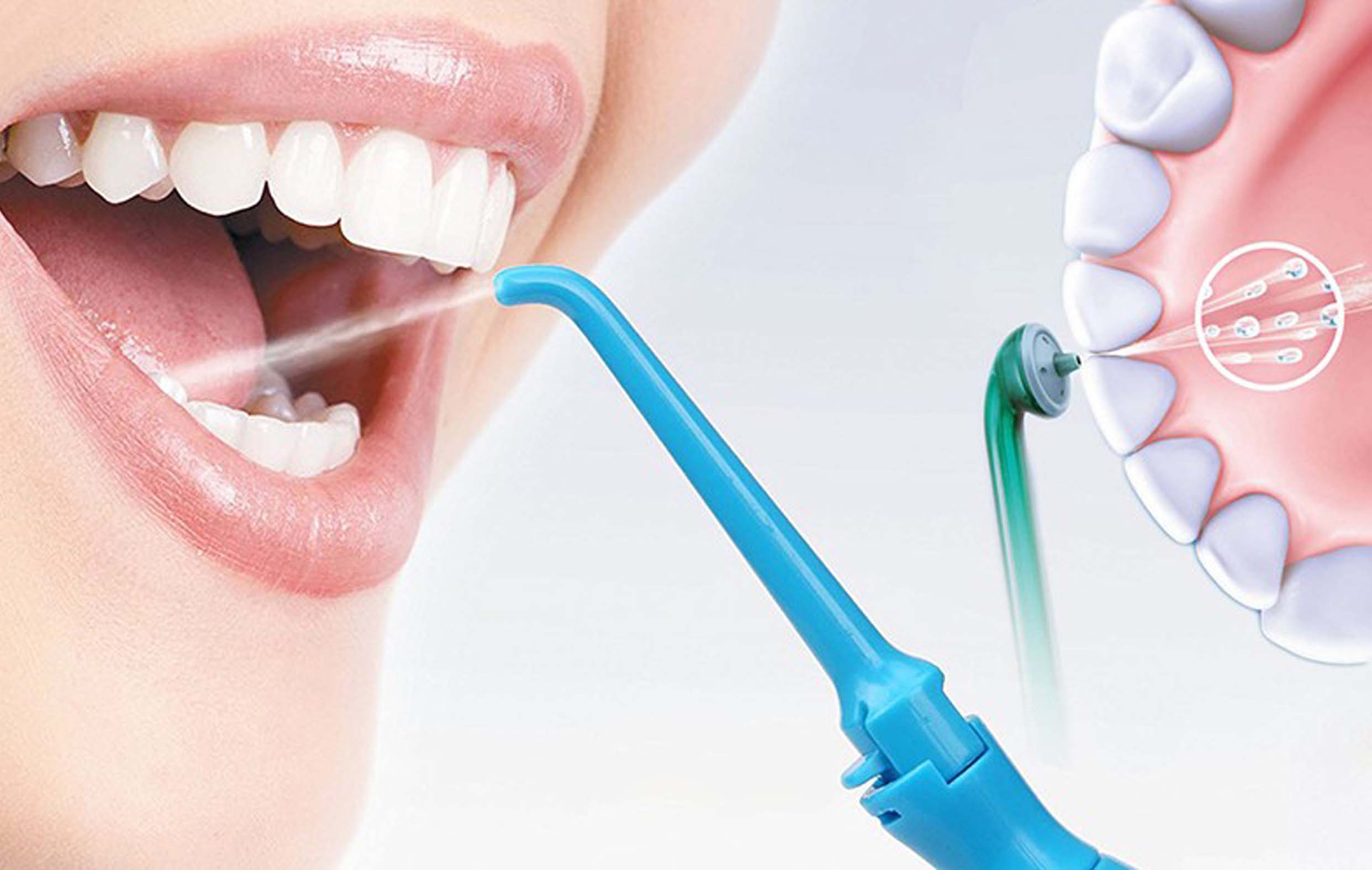 Что такое чистка зубов Air Flow в стоматологии?