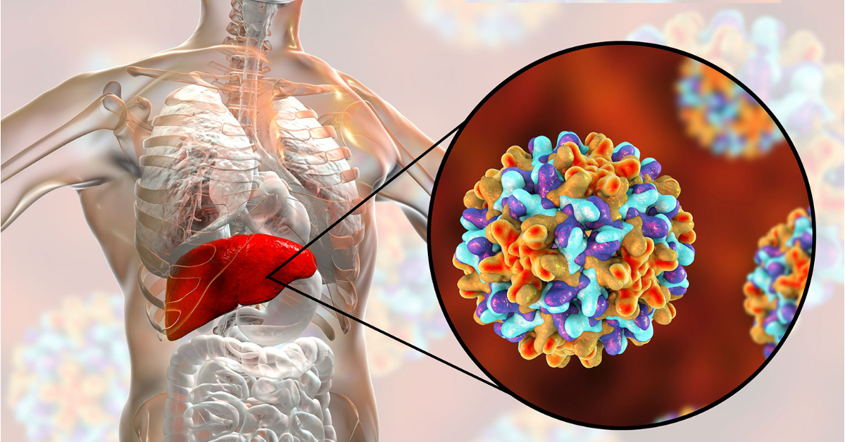 Лечение гепатита В: эффективные методы и препараты
